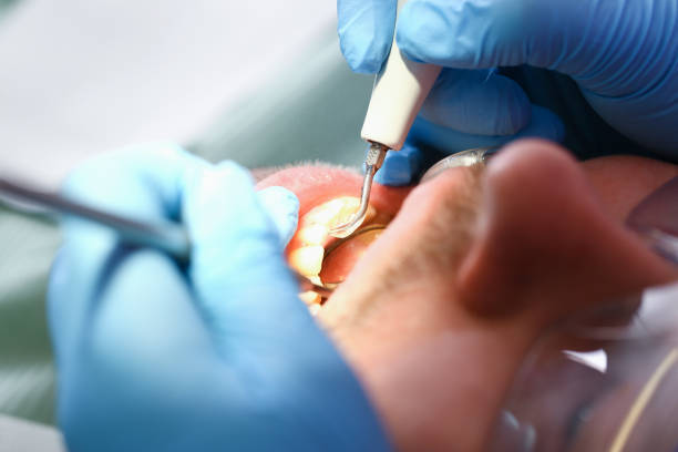 Best Tooth Pain Emergency Relief  in New Haven, MI