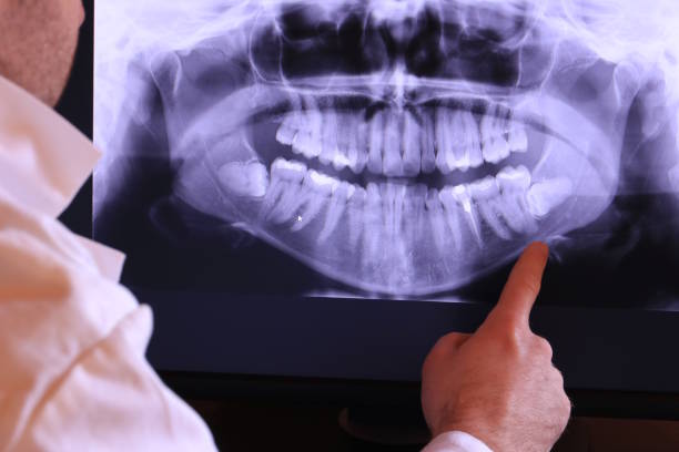 Best Dentist for Dental Trauma  in New Haven, MI